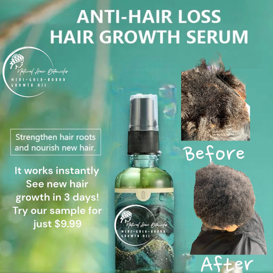 Merigoround alopecia hair growth  oil